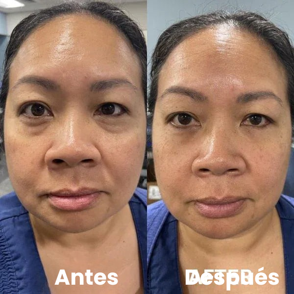 Parches Para Ojos InstantFirm