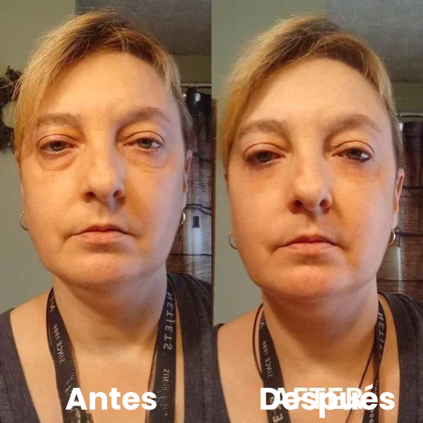 Parches Para Ojos InstantFirm