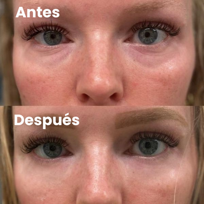 Parches Para Ojos InstantFirm
