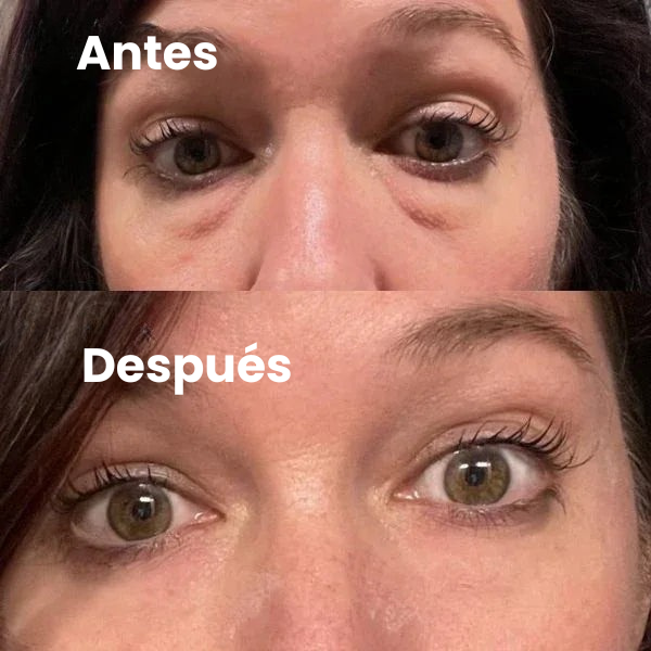 Parches Para Ojos InstantFirm