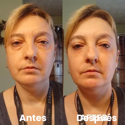 Parches Para Ojos InstantFirm